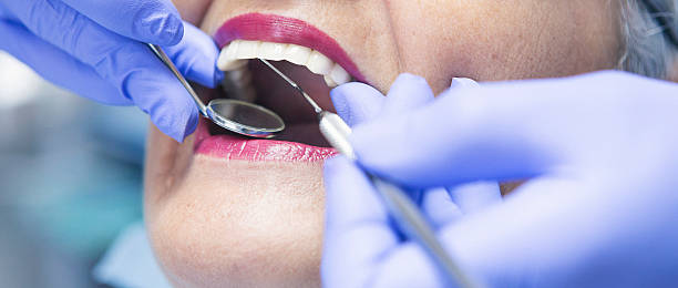 Best Broken or Cracked Tooth Emergency Dentist in Resaca, GA